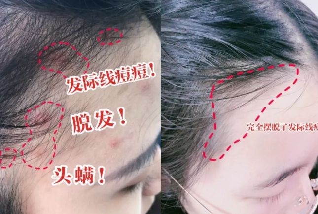 10分钟轻松养成女明星「绸缎发」新葡京洗完头自然风干还是吹干好？(图2)